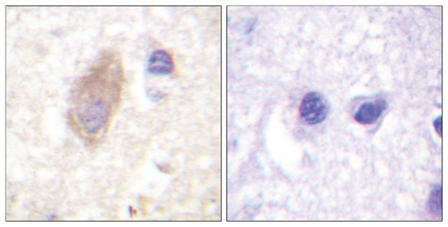 Anti-Rabphilin 3A antibody produced in rabbit