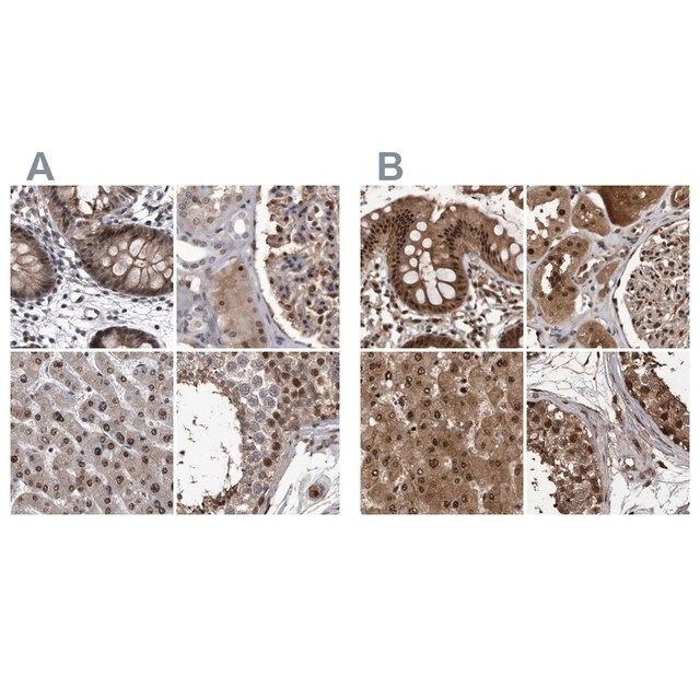 Anti-RAD23B antibody produced in rabbit