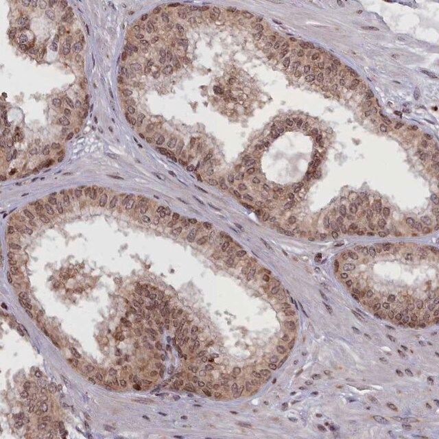 Anti-RABL6 antibody produced in rabbit