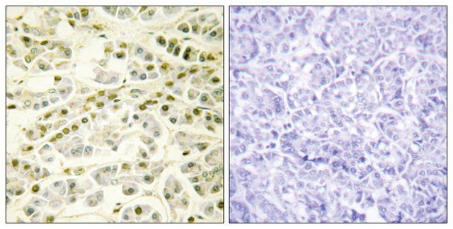 Anti-RAD51L1 antibody produced in rabbit