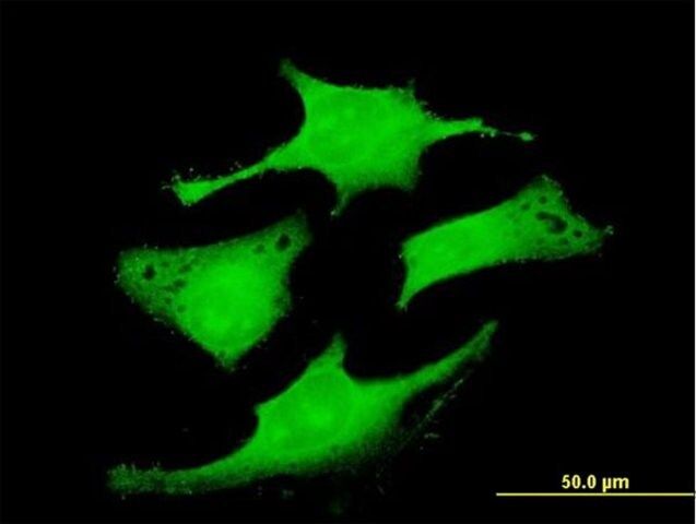 Anti-RAB6IP1 antibody produced in mouse