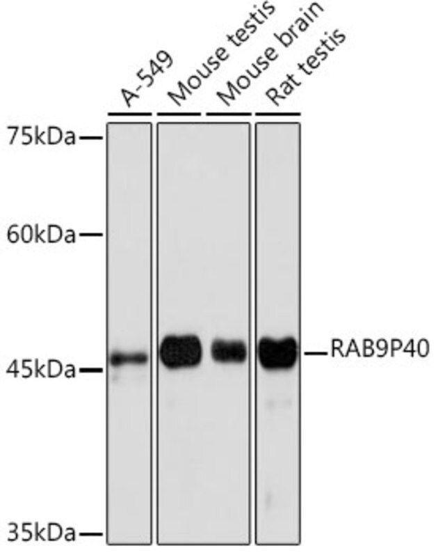 Anti-RAB9P40 antibody produced in rabbit