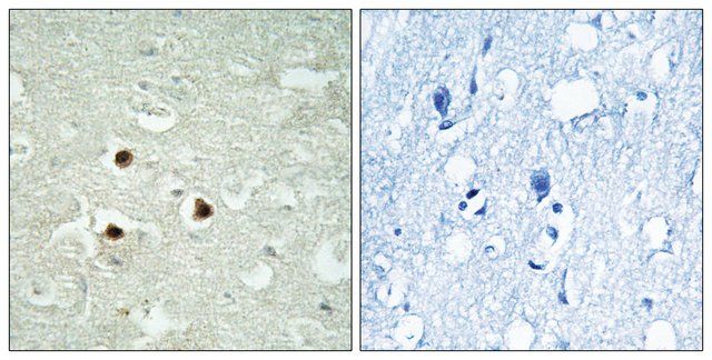 Anti-RAB3IP antibody produced in rabbit