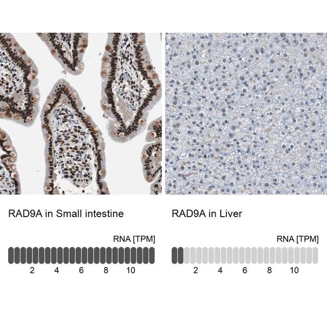 Anti-RAD9A antibody produced in rabbit