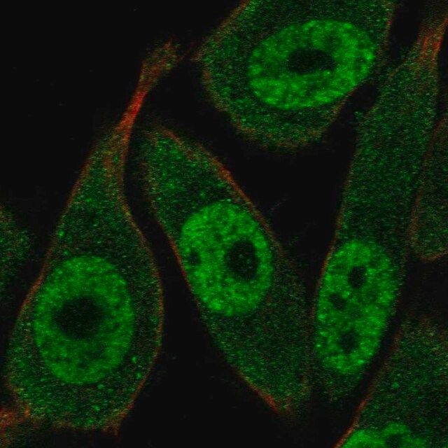 Anti-Rad23A antibody produced in rabbit