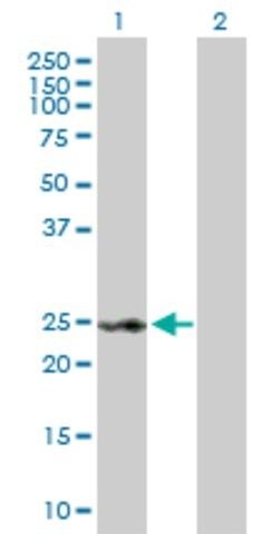 Anti-RAD54B antibody produced in rabbit