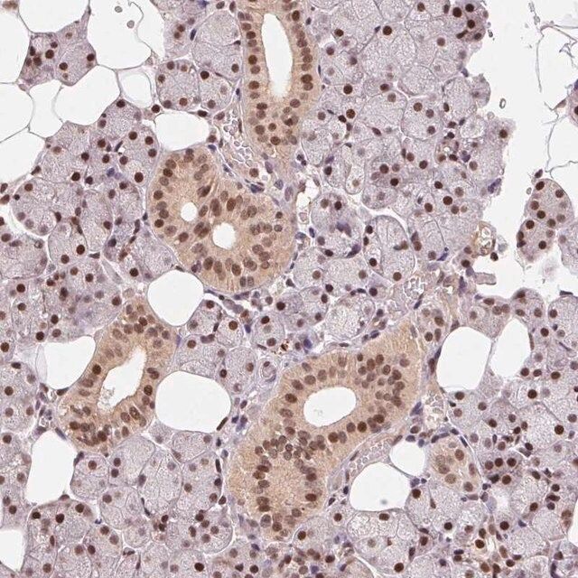 Anti-Rad23A antibody produced in rabbit