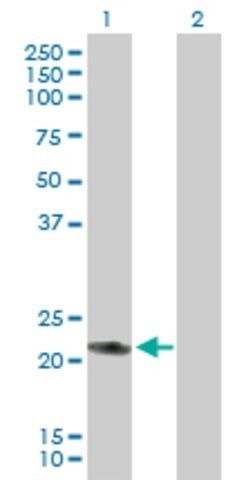 Anti-RAB7L1 antibody produced in mouse