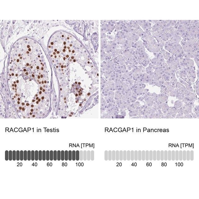 Anti-RACGAP1 antibody produced in rabbit