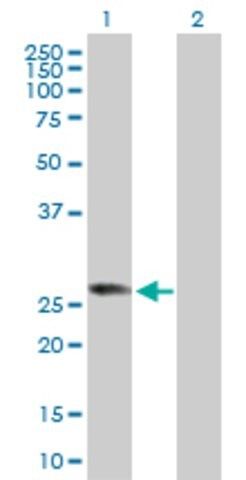 Anti-RABL2B antibody produced in rabbit