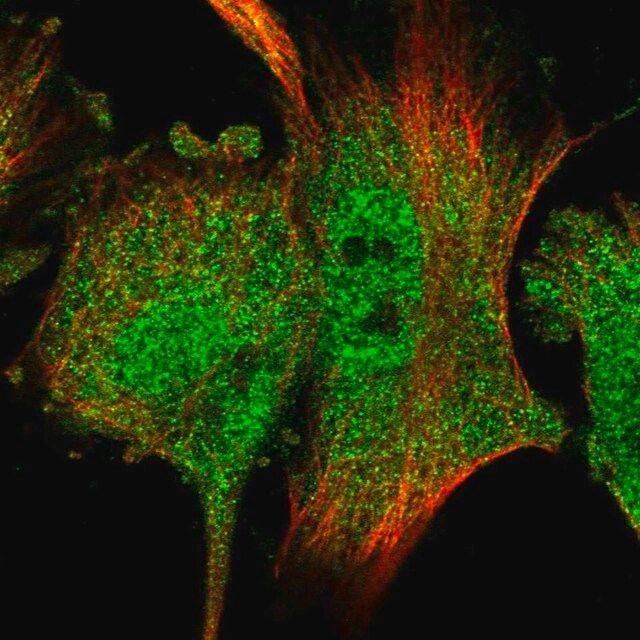 Anti-RACK1 antibody produced in rabbit