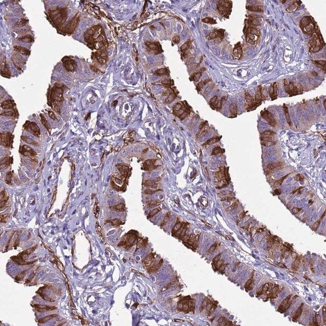 Anti-RABL2A antibody produced in rabbit