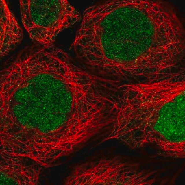 Anti-RAD51AP1 antibody produced in rabbit