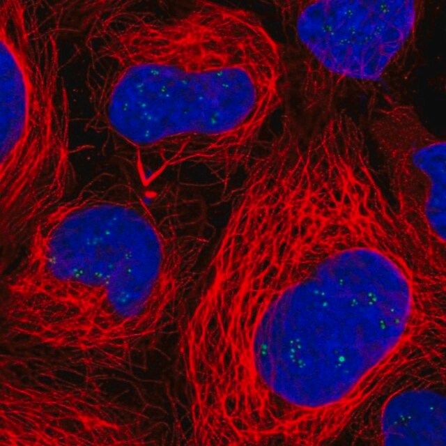 Anti-RAE1 antibody produced in rabbit