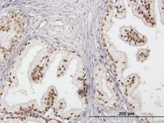 Anti-RAD23B antibody produced in mouse