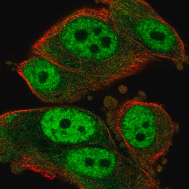 Anti-Rad23A antibody produced in rabbit