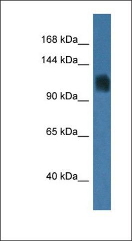 Anti-RAG1 antibody produced in rabbit