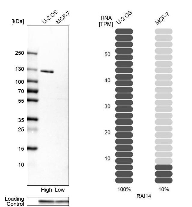 Anti-RAI14 antibody produced in rabbit