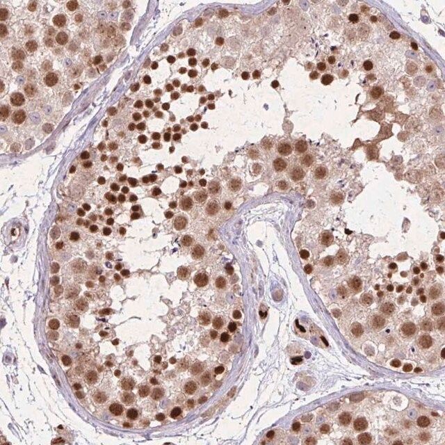 Anti-RAD21L1 antibody produced in rabbit