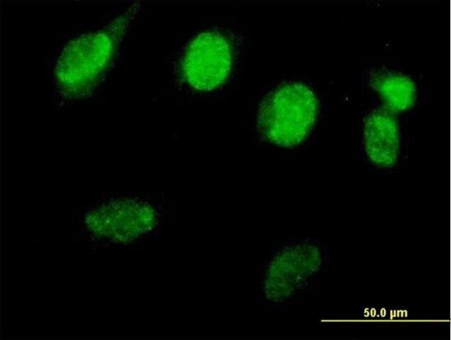 Anti-RAD51L3 antibody produced in mouse