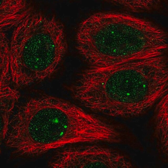 Anti-RAD51B antibody produced in rabbit