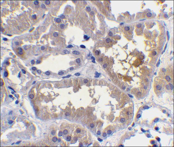 Anti-RAIDD antibody produced in rabbit