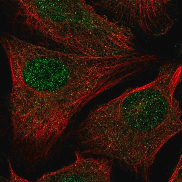 Anti-RAD54L2 antibody produced in rabbit