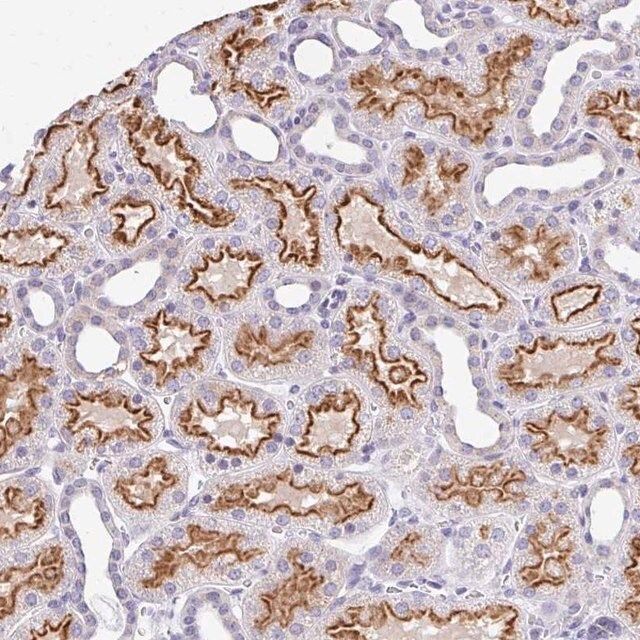 Anti-RADIL antibody produced in rabbit