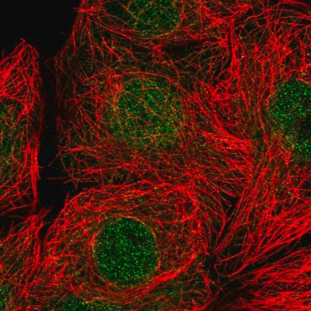 Anti-RAD9A antibody produced in rabbit