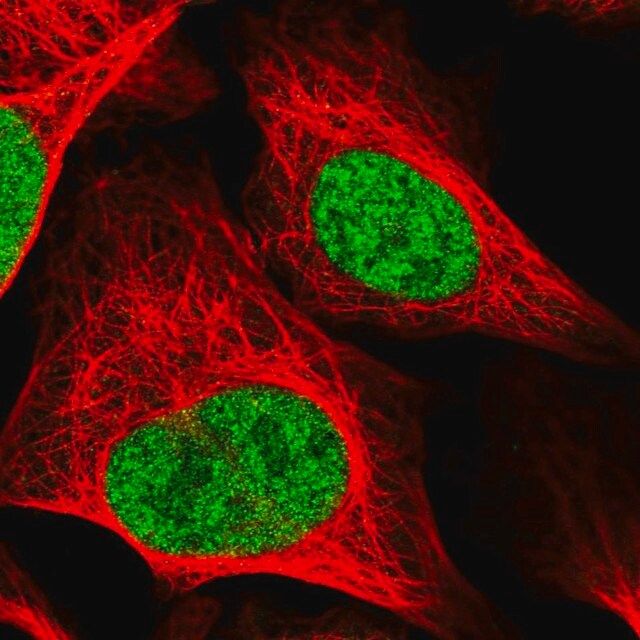 Anti-RAD54L antibody produced in rabbit