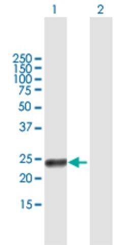 Anti-RAET1G antibody produced in mouse