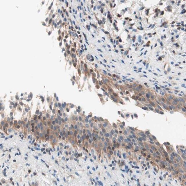 Anti-RAD54B antibody produced in rabbit