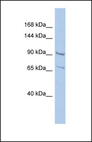 Anti-RALGDS, (N-terminal) antibody produced in rabbit