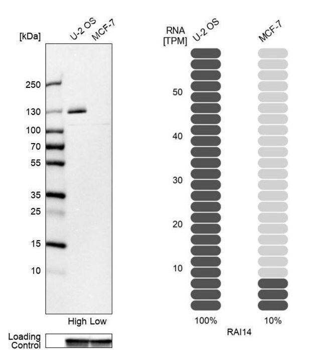 Anti-RAI14 antibody produced in rabbit