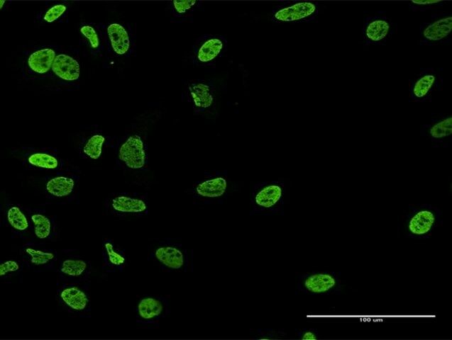 Anti-RALYL antibody produced in mouse