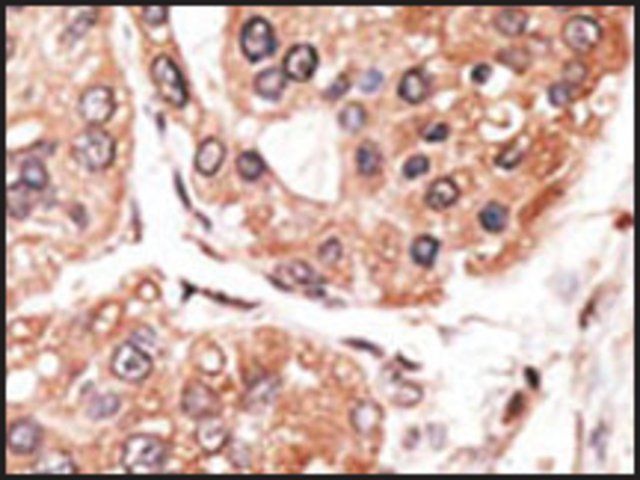 Anti-RAI15 (C-term) antibody produced in rabbit