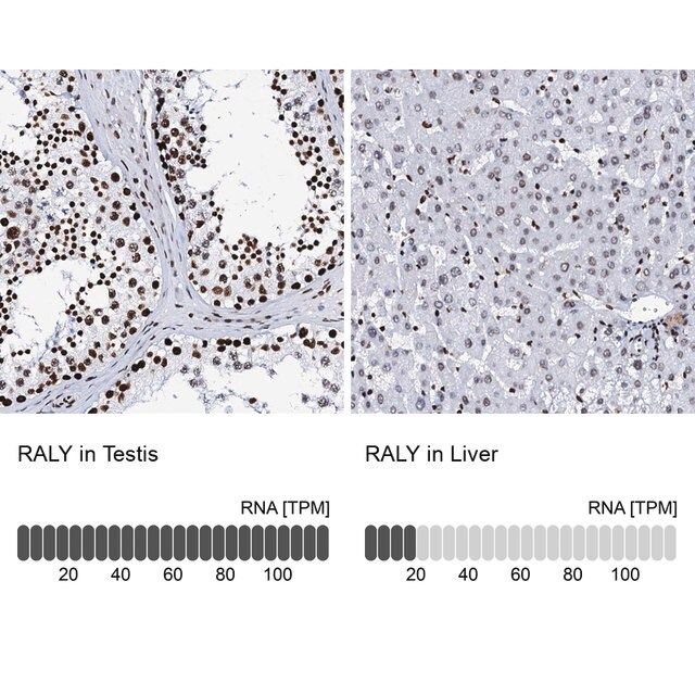 Anti-RALY antibody produced in rabbit