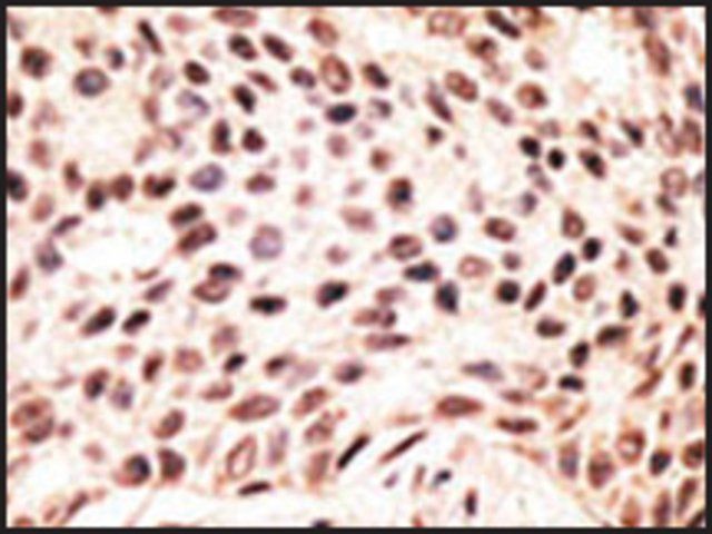 Anti-RAI14 (C-term) antibody produced in rabbit