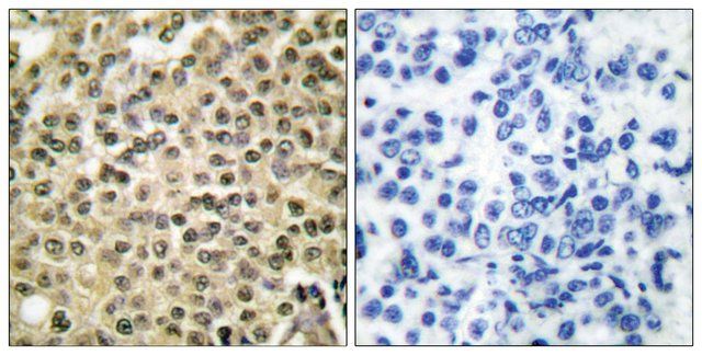 Anti-RAN, C-Terminal antibody produced in rabbit