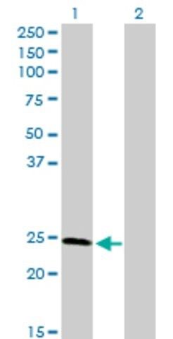 Anti-RAD51L3 antibody produced in rabbit