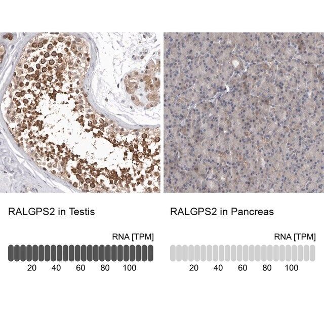 Anti-RALGPS2 antibody produced in rabbit