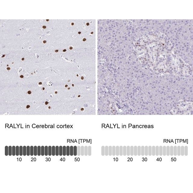 Anti-RALYL antibody produced in rabbit