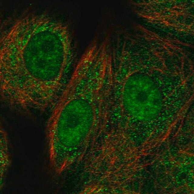 Anti-RAD51C antibody produced in rabbit