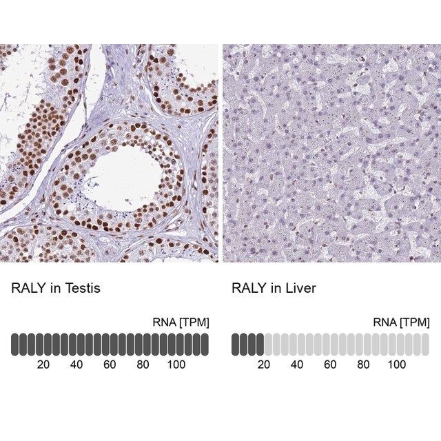 Anti-RALY antibody produced in rabbit