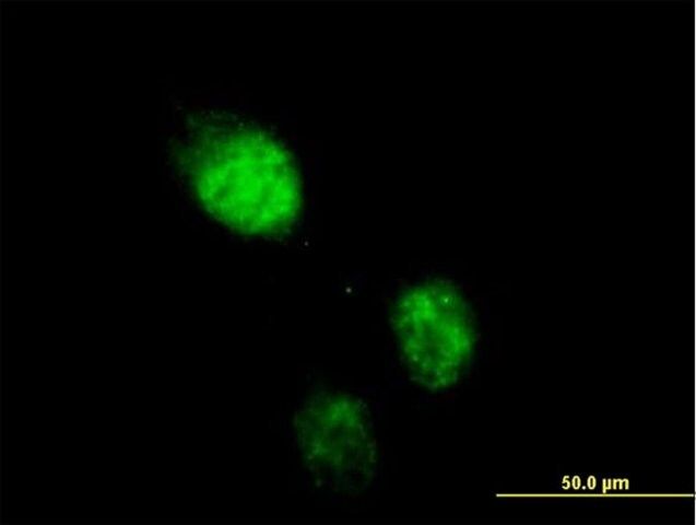 Anti-RAD23B antibody produced in mouse