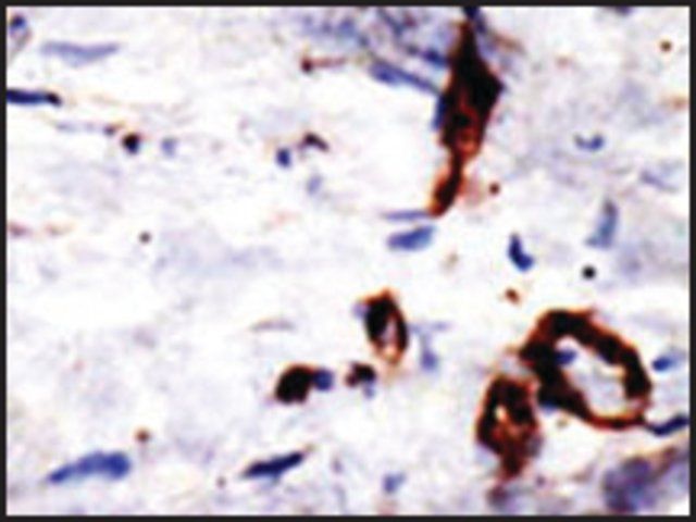 Anti-RANBP2 (N-term) antibody produced in rabbit