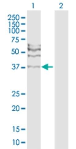 Anti-RAD51C antibody produced in rabbit