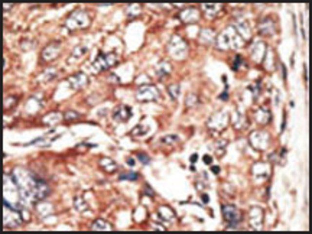 Anti-RAI2 (C-term) antibody produced in rabbit