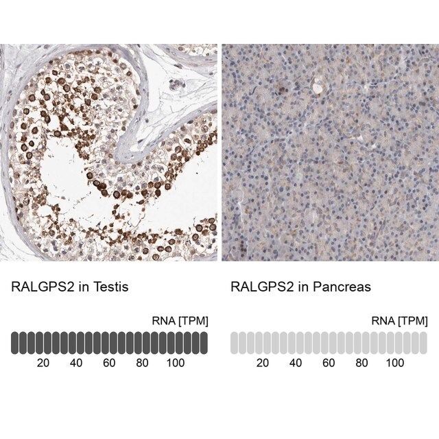 Anti-RALGPS2 antibody produced in rabbit