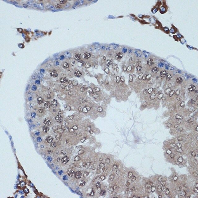 Anti-RANBP9 antibody produced in rabbit